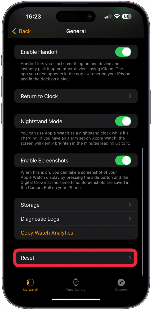 Apple watch contacts not synced sale