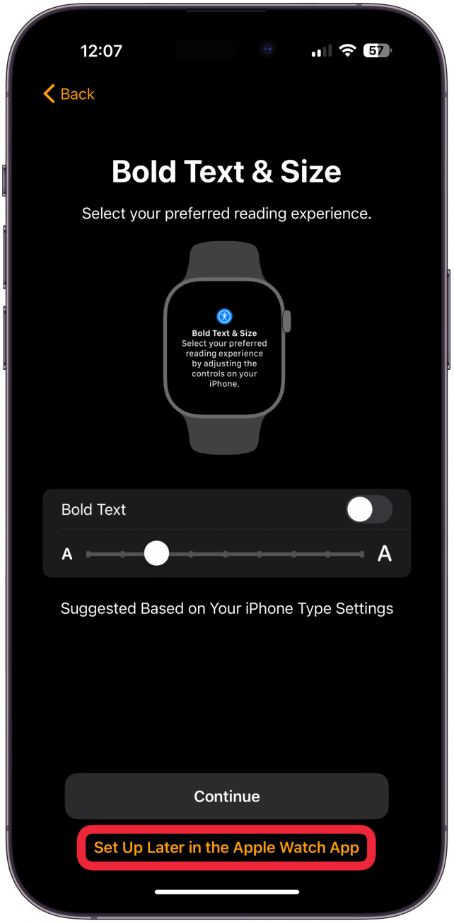  tap Set Up Later in the Apple Watch App to skip these for now.